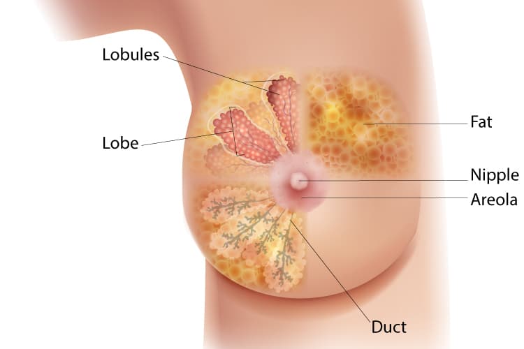 Breast cancer treatment in Nagpur