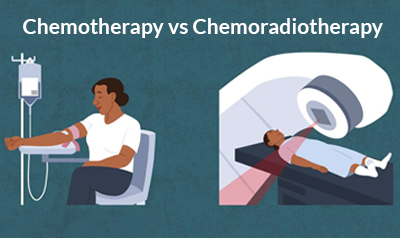 What is Chemoradiotherapy? Is it similar to Chemotherapy?