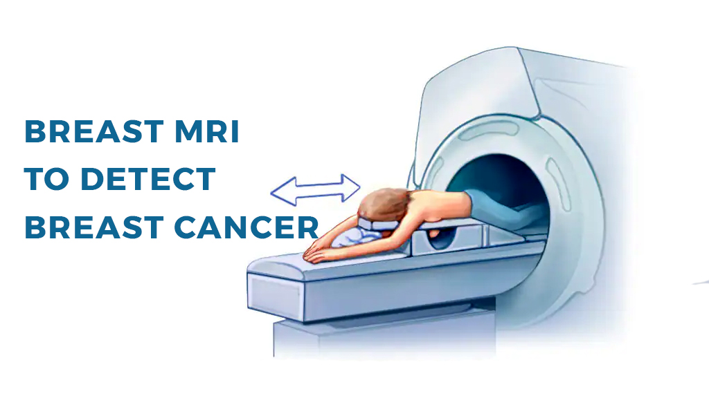 Breast MRI To Detect Breast Cancer: Purpose, Results, Risks